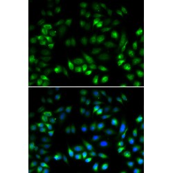 Mesencephalic Astrocyte Derived Neurotrophic Factor (MANF) Antibody