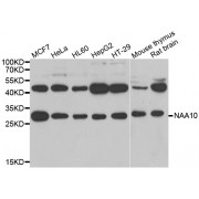 Western blot analysis of extracts of various cell lines, using NAA10 antibody (abx005310) at 1/1000 dilution.