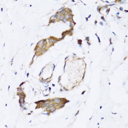 N-Alpha-Acetyltransferase 10 (NAA10) Antibody