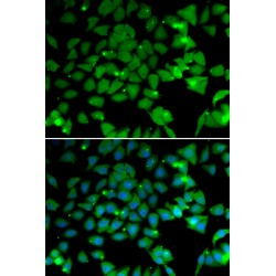 N-Alpha-Acetyltransferase 10 (NAA10) Antibody