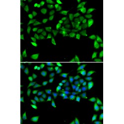 Eukaryotic Translation Initiation Factor 3 Subunit H (EIF3H) Antibody