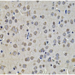 DnaJ Heat Shock Protein Family (Hsp40) Member A3 (DNAJA3) Antibody