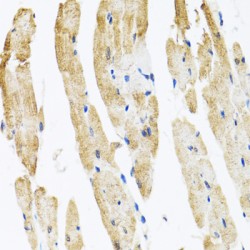 Coatomer Protein Complex Subunit Beta 2 (COPB2) Antibody