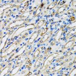 Coatomer Protein Complex Subunit Beta 2 (COPB2) Antibody