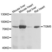 Western blot analysis of extracts of various cell lines, using TGM5 antibody (abx005329) at 1/1000 dilution.