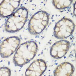 Transglutaminase 5 (TGM5) Antibody