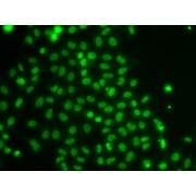 Immunofluorescence analysis of U2OS cells using TOX antibody (abx005337).