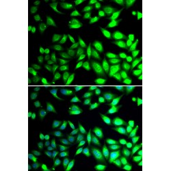 Protein Disulfide Isomerase A6 (PDIA6) Antibody