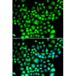 B-Cell Receptor-Associated Protein 31 (BCAP31) Antibody