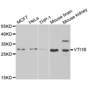 Western blot analysis of extracts of various cell lines, using VTI1B antibody (abx005344) at 1/1000 dilution.