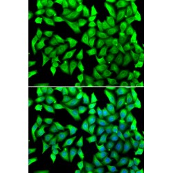 Vesicle Transport Through Interaction With T-SNAREs Homolog 1B (VTI1B) Antibody