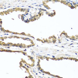 Opioid Growth Factor Receptor (OGFR) Antibody