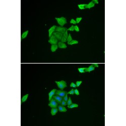 Tumor Suppressor Candidate 2 (TUSC2) Antibody