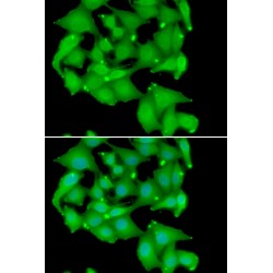 Protein Kinase D3 (PRKD3) Antibody