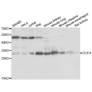 Western blot analysis of extracts of various cell lines, using CLIC4 antibody (abx005358) at 1/1000 dilution.