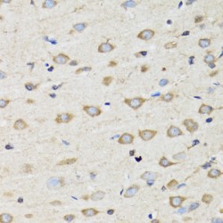 Chloride Intracellular Channel Protein 4 (CLIC4) Antibody