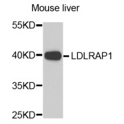 Western blot analysis of extracts of mouse liver, using LDLRAP1 antibody (abx005362) at 1/1000 dilution.