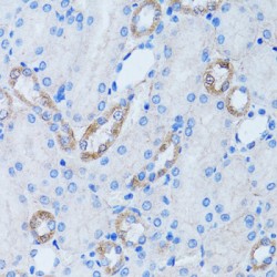 Low Density Lipoprotein Receptor Adaptor Protein 1 (LDLRAP1) Antibody