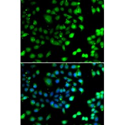 N-Terminal Xaa-Pro-Lys N-Methyltransferase 1 (NTMT1) Antibody