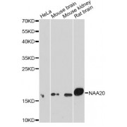 Western blot analysis of extracts of various cell lines, using NAA20 antibody (abx005368) at 1/1000 dilution.