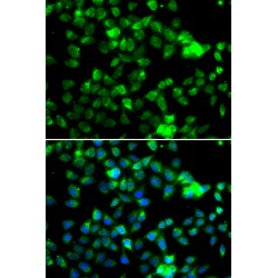 N-Alpha-Acetyltransferase 20 (NAA20) Antibody