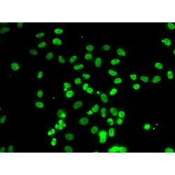 Actin-Like Protein 6B (ACTL6B) Antibody