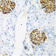 Immunohistochemistry of paraffin-embedded rat kidney using CSRNP1 antibody (abx005384) at dilution of 1/200 (40x lens).
