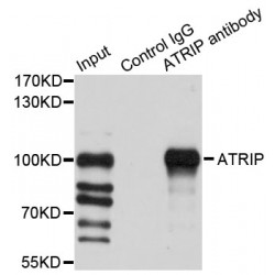 ATR-Interacting Protein (ATRIP) Antibody