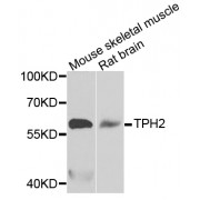 Western blot analysis of extracts of various cell lines, using TPH2 antibody (abx005394) at 1/1000 dilution.