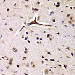 Eukaryotic Translation Initiation Factor 2 Alpha Kinase 4 (EIF2AK4) Antibody