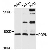 Western blot analysis of extracts of various cell lines, using PDPN antibody (abx005408) at 1/1000 dilution.