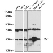 Western blot analysis of extracts of various cell lines, using ETV1 antibody (abx005419) at 1/1000 dilution.