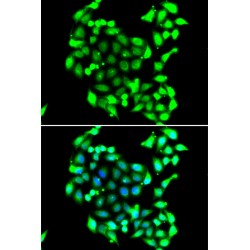 General Transcription Factor IIH, Polypeptide 3 (GTF2H3) Antibody