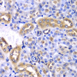 Synaptotagmin Binding Cytoplasmic RNA Interacting Protein (SYNCRIP) Antibody