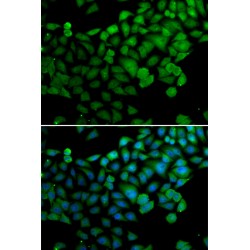 Synaptotagmin Binding Cytoplasmic RNA Interacting Protein (SYNCRIP) Antibody