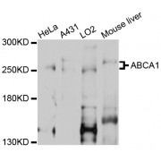 Western blot analysis of extracts of various cell lines, using ABCA1 antibody (abx005455) at 1/1000 dilution.