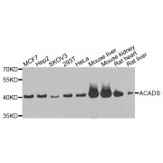 Western blot analysis of extracts of various cell lines, using ACADS antibody (abx005457) at 1/1000 dilution.