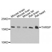 Western blot analysis of extracts of various cell lines, using THRSP antibody (abx005459) at 1/1000 dilution.