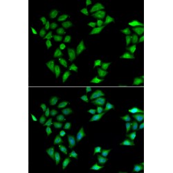 Intelectin 1/Omentin (ITLN1) Antibody