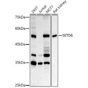 WB analysis of extracts of various cell lines, using SETD6 antibody (1/1000 dilution).