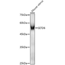 SET Domain Containing Protein 6 (SETD6) Antibody