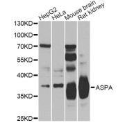 Western blot analysis of extracts of various cell lines, using ASPA Antibody (abx005478) at 1/500 dilution.