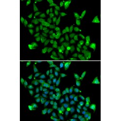 Aspartoacylase (ASPA) Antibody