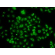 Immunofluorescence analysis of A-549 cells, using ATOH7 antibody and Cy3-conjugated goat anti-rabbit IgG secondary antibody (<a href="https://www.abbexa.com/index.php?route=product/search&search=abx005541" target="_blank">abx005541</a>, 1/500 dilution).