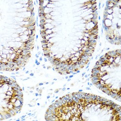 C-C Motif Chemokine 2 / MCP1 (CCL2) Antibody