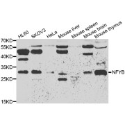 Western blot analysis of extracts of various cell lines, using NFYB antibody (abx005502) at 1/500 dilution.