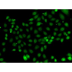 Nuclear Transcription Factor Y Subunit Beta (NFYB) Antibody