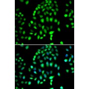 Immunofluorescence analysis of MCF-7 cells using PARP3 antibody (abx005504). Blue: DAPI for nuclear staining.