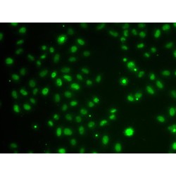 POU Domain, Class 6, Transcription Factor 1 (POU6F1) Antibody