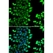 Immunofluorescence analysis of MCF-7 cells using RNF7 antibody (abx005508). Blue: DAPI for nuclear staining.